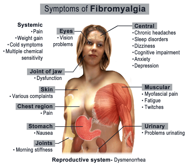 fibromialgia simptome si tratament naturist